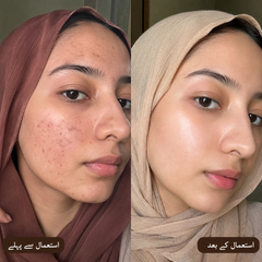 Rice Extract Facial Kit For Bright & Glowing Skin – 6-Step Complete Facial Kit (Free Rice Serum Inside)